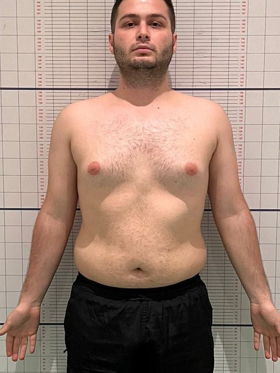 Öncesi